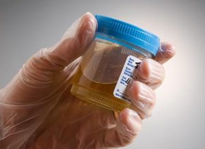 Toxicology medication monitoring services for physician practices